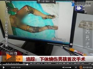 多毛阴户视频,私密部位的生理与美学探讨